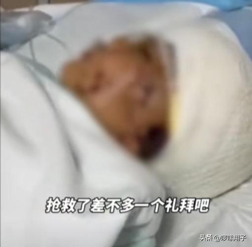 7岁男孩遭3只犬撕咬,7岁男孩遭3只犬撕咬怎么办